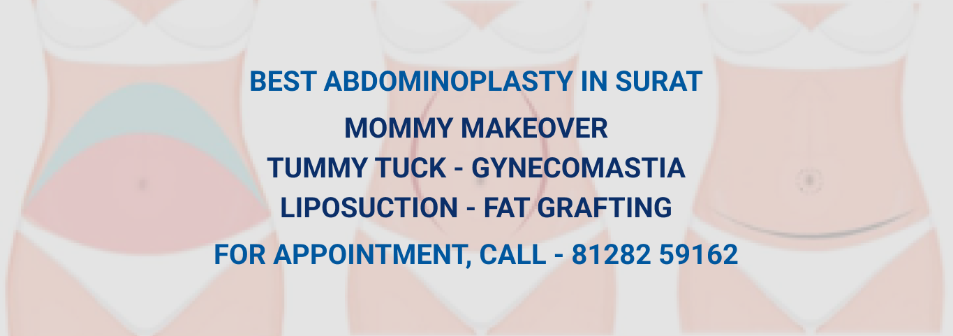 abdominoplasty-image