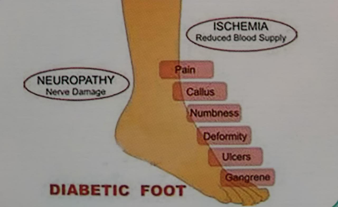 diabetic-foot-care-image