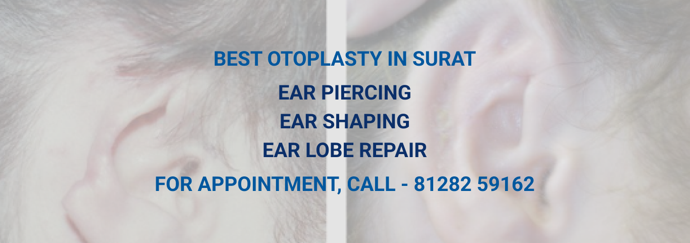 ear-surgery-image