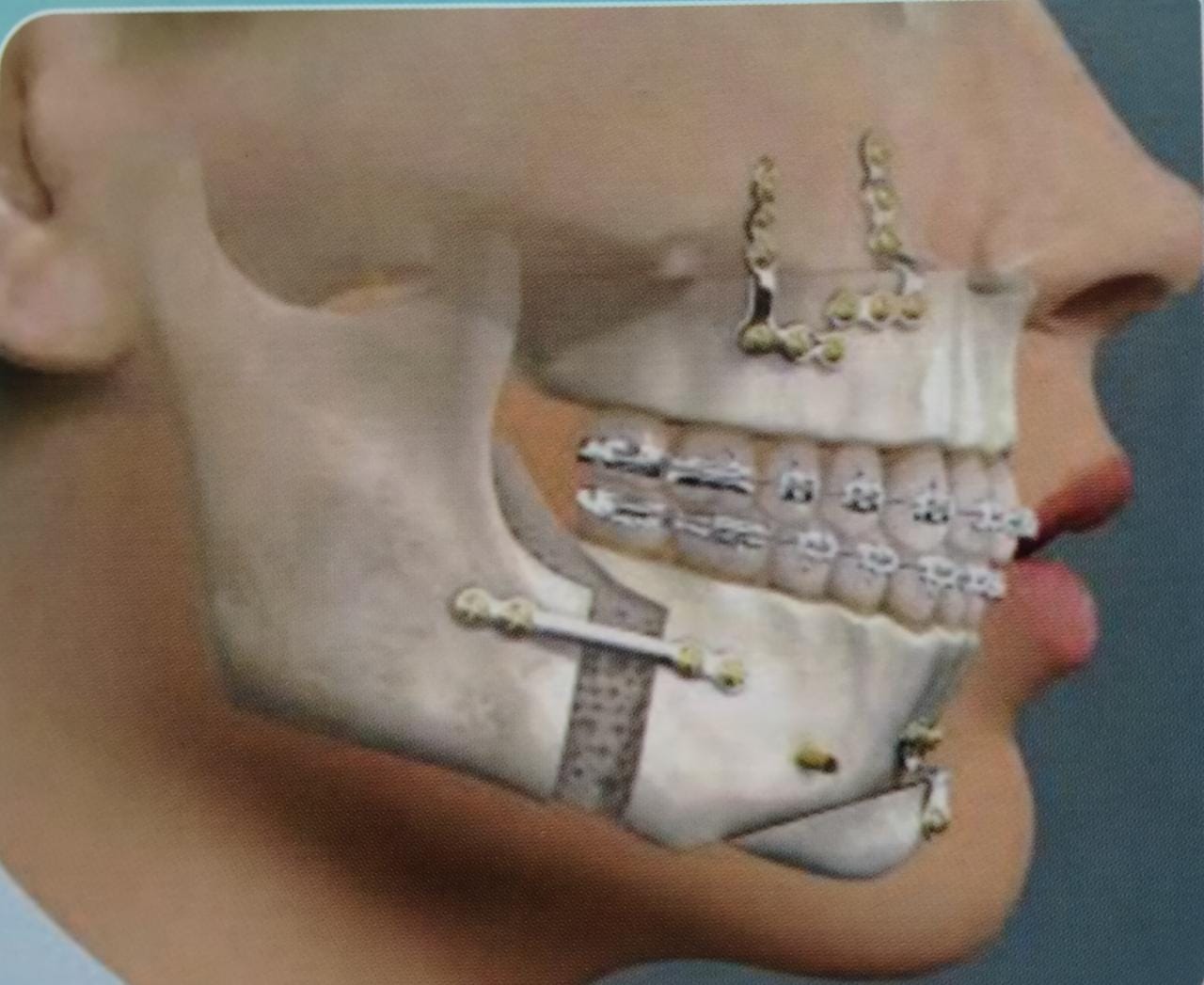facial-bone-image