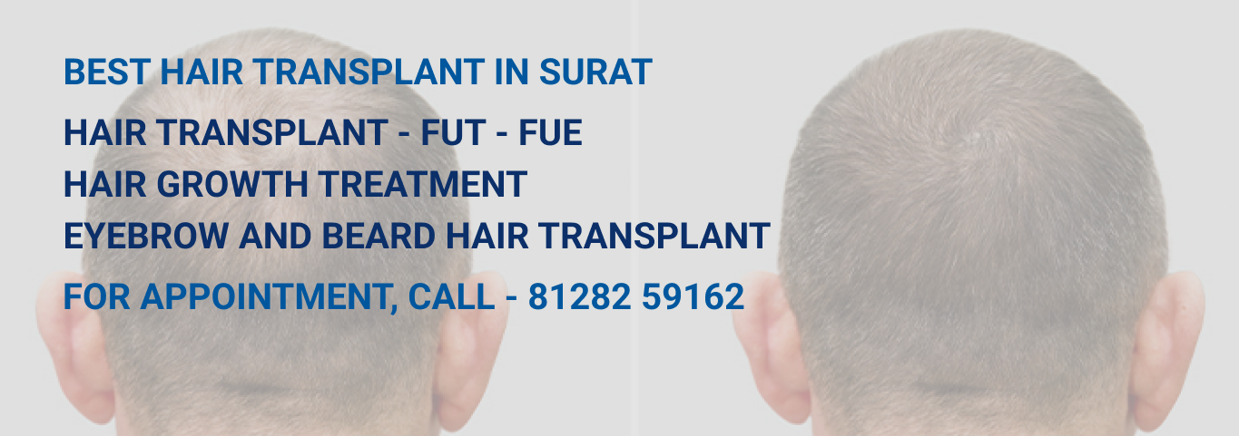 Innovative Cure Hair Replacement Center in Majura Gate,Surat - Best Hair  Treatment Clinics in Surat - Justdial