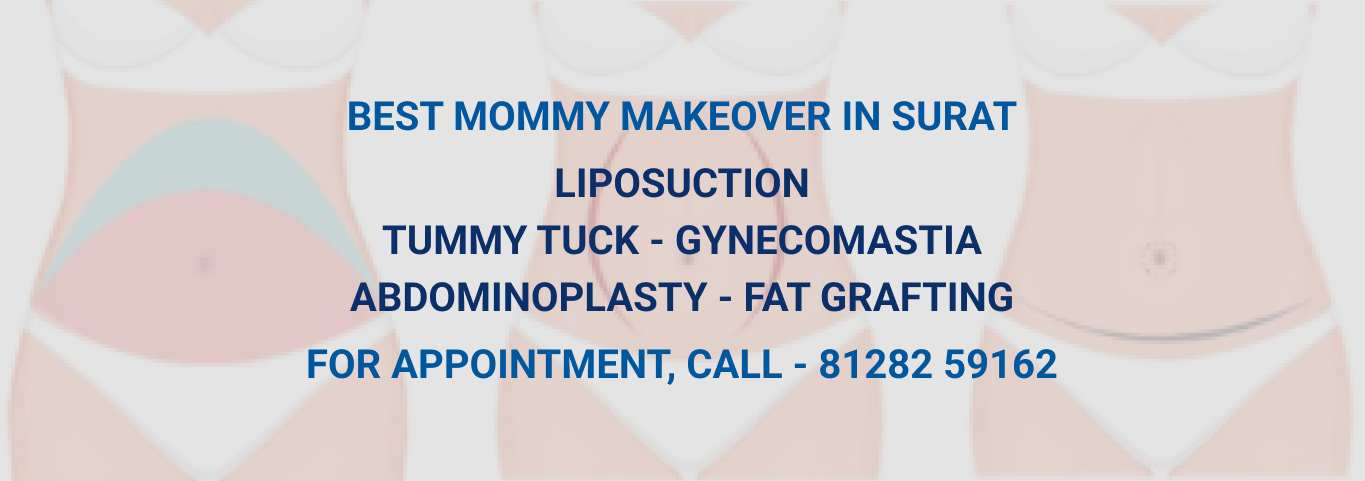 mommy-makeover-image